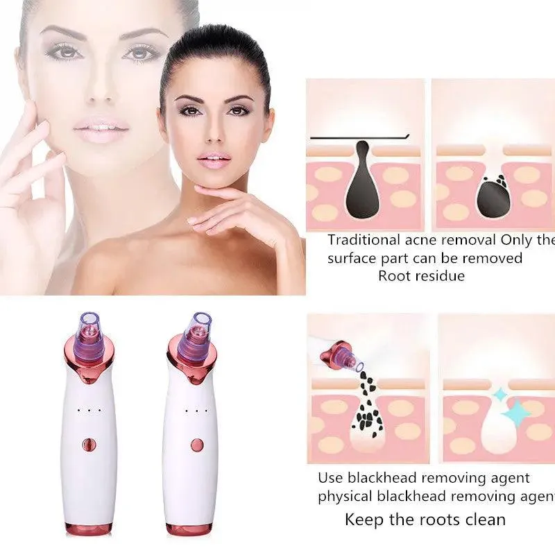 Blackhead Remover Acne Vacuum | Skin Care Tool